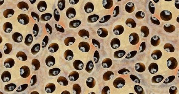 What Causes Trypophobia, The Fear Of Small Holes?